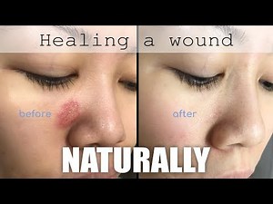 Healing a face wound naturally