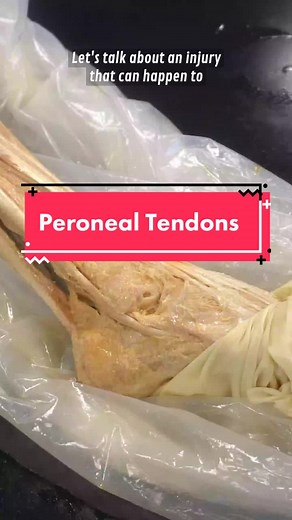 Understanding Ankle Injuries and Muscles: Peroneal Tendons Explained
