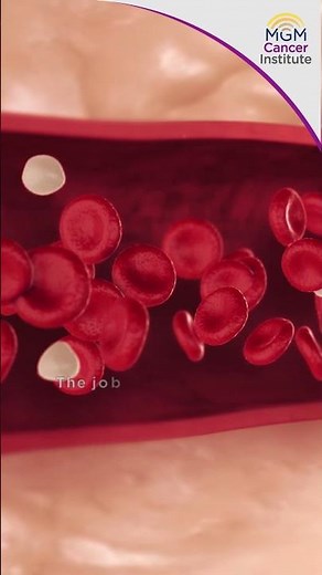 Acute myeloid leukemia (AML)