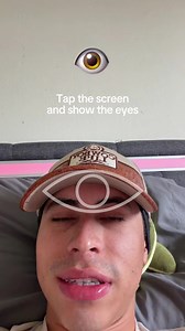 How to Identify Your Eye Type: Seiller/Seidler Eye Zoom Photo Guide