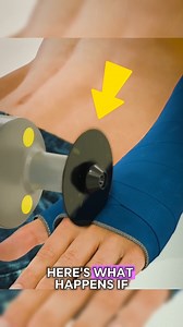 The Strange Reason Why a Cast Saw Affects Your Skin 🩺 The weird reason why a cast saw affects your skin will surprise you! This powerful medical tool doesn’t actually cut — it vibrates safely, removing casts without harm. A fascinating blend of science, safety, and precision technology. ⚙️ #MedicalTech #Innovation #HealthCare #technology #safety Credits : Zack D. Films, Steve Mould, Howz, Experio, Boston Children's Hospital, Growing Bones / yt | Kerala News