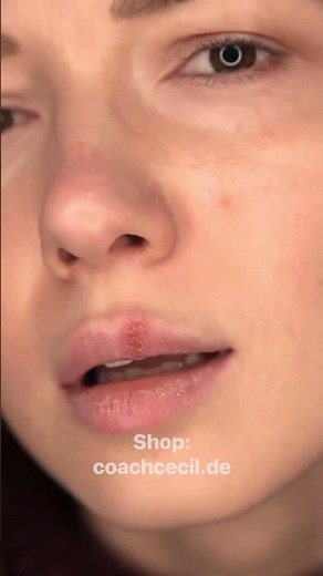 Warum Lysin eine besondere Aminosäure ist. Hinweise:Keine Empfehlung #gesundheit #lysin #protein