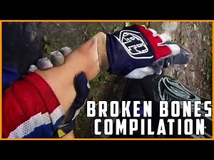 GoPro Broken Bones Compilation