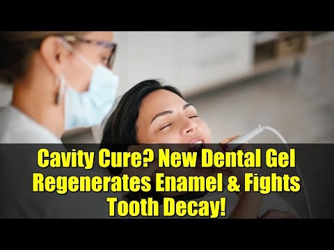 Cavity Cure? New Dental Gel Regenerates Enamel & Fights Tooth Decay!