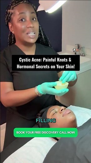 Cystic Acne - Painful Knots & Hormonal Secrets on Your Skin!