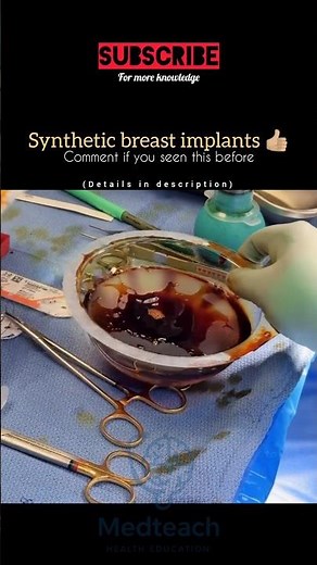 “💉 Synthetic Breast Implantation Explained | Before & After Science!” #youtubeshorts #medicalshorts
