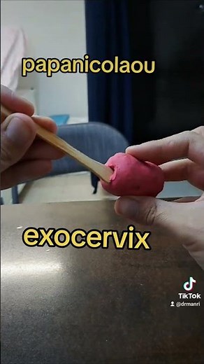 cómo se hace un papanicolaou