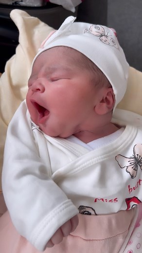 Ne büyük bir mücize emme refleksi.. Bu bebeğim dünyaya geleli daha bir saat bile olmadı, ama öyle güzel emme refleksi varki, hazırda bekliyor sanki annesini 😅🙈 Emme, doğumdan önce bile mevcut olan hayatta kalma reflekslerinden biri. Aslında, hamilelik sırasında ultrasonda da bebeğin bu emme refleksini sıklıkla görüyoruz 🥰 Doğumdan sonra meme başı ve areola bebeğinizin ağzına derin bir şekilde yerleştirildiğinde, kendiliğinden emmeye başlar. Diyorum ya bebeğin her hareketi, her refleksi ayrı b