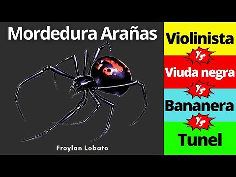 Picadura de araña 🕷️| Diagnóstico y Tratamiento | Violinista, Viuda negra, Bananera
