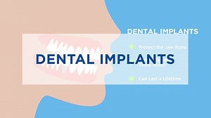 7.3K views · 95 reactions | Dental implant surgery is, of course, surgery, and is best done by a trained surgeon. Oral and maxillofacial surgeons (OMSs) have the specialized education and training in the complexities of the involved bone, skin, muscles and nerves to ensure the best results. Learn at MyOMS.org why OMSs should place implants. | American Association of Oral and Maxillofacial Surgeons - AAOMS | Facebook