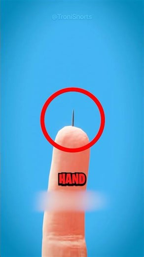 How To Remove A Splinter! 😨