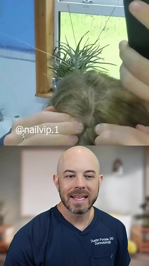 Incredible Pilar Cyst Removal Process