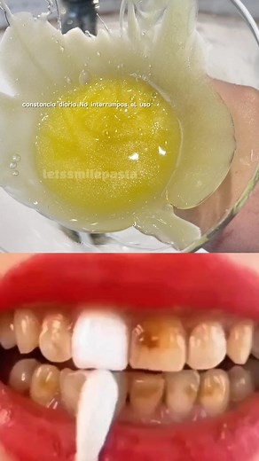Si quieres que tus dientes se vean más bonitos, tienes que probar esta pasta dental sí o sí#letssmile #PastaDental #TikTokMexico #Whitening #teeth