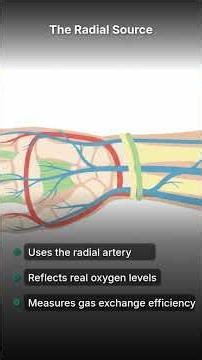 ABGs Arterial or venous blood #criticalcare #nclexstudyguide #nclex #hospital #icu #ventilator