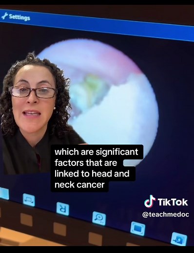 #greenscreen 🥺 THIS is Tonsil Cancer (Answer to Guess The Diagnosis). Signs to be suspicious of any head and neck cancer include: sores that aren't healing, bleeding in the mouth or throat repeatedly, lumps in the mouth or neck, change in voice, problems swallowing or numbness in the face. 🍺🚬Smoking & drinking alcohol are strongly associated with head and neck cancers in OLDER adults 🦠 HPV (human papillomavirus) is strongly associated with head and neck cancers in YOUNG adults. Please consid