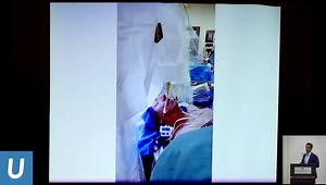 Deep Brain Stimulation (DBS) Indications and Limitations