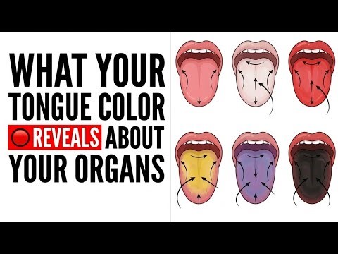 7 Tongue Signs Your Body is in Trouble