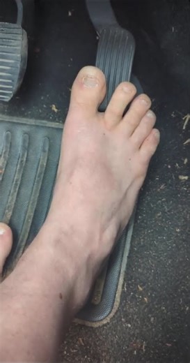 Driving Manual Transmission Barefoot with Big Toe on Pedal