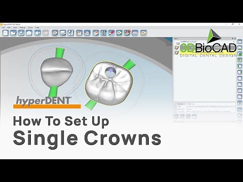 How To Set Up Single Crowns l FOLLOW-ME! hyperDENT l 3DBioCAD