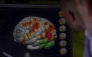 医学推理剪辑-315上-学者综合征_哔哩哔哩_bilibili