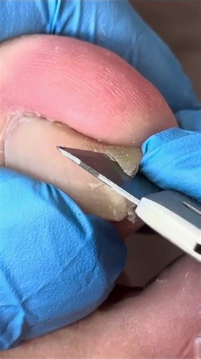 Curl the tip of your toenails into a circle and trim them. #nails #pedicure