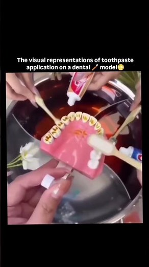 The visual representations of toothpaste application on a dental / model 👀❤️‍🩹