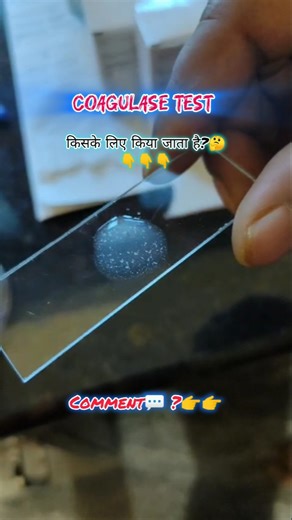 Coagulase test👉👉🔎🧫🦠#microbiology #medicallab #labtechnician #shortsforyou #viralvideo