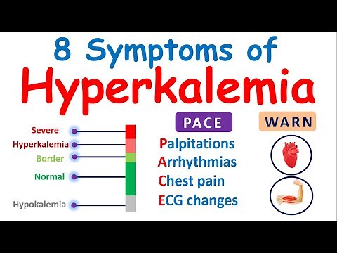 Hyperkalemia - 8 important symptoms of high potassium