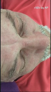 466K views · 1.2K reactions | New Hope New Goal 2K25  | Dr. Pimple Popper | Facebook