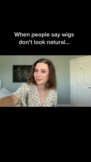 Sharing my alopecia journey :) #alopecia #wigs #hairloss