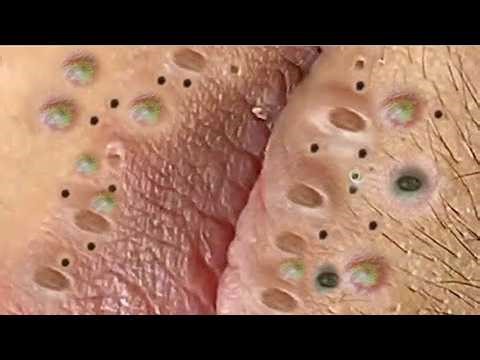 𝑺𝒐𝒐𝒕𝒉𝒊𝒏𝒈 𝑭𝒂𝒄𝒊𝒂𝒍 𝑻𝒓𝒆𝒂𝒕𝒎𝒆𝒏𝒕 𝒇𝒐𝒓 𝑺𝒕𝒓𝒆𝒔𝒔 𝑹𝒆𝒍𝒊𝒆𝒇 | 𝑫𝒆𝒆𝒑 𝑪𝒍𝒆𝒂𝒏𝒊𝒏𝒈 & 𝑪𝒂𝒍𝒎𝒊𝒏𝒈 𝑴𝒂𝒔𝒔𝒂𝒈𝒆 𝒂𝒕 𝑳𝒖𝒙𝒖𝒓𝒚 𝑺𝒑𝒂 #887585