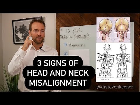 3 Signs of Head and Neck Misalignment | Dr. K’s Sunday Special