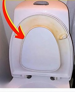 Die gelben Flecken unter dem Toilettensitz – ich weiß nicht, wie es euch geht, aber für mich sind sie ein echter visueller Albtraum! Sie vermitteln den Eindruck von Vernachlässigung, obwohl wir wissen, dass das nicht unbedingt an mangelnder Pflege liegt. Zum Glück muss man nicht auf aggressive chemische Produkte zurückgreifen, um dieses Problem zu lösen. Ich habe einige natürliche Lösungen gefunden, die Wunder wirken, und sie sind außerdem super einfach anzuwenden! Egal, ob es darum geht, Kalkab