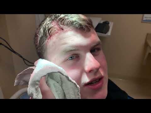 Farm Accident Resulting In A ER Visit!