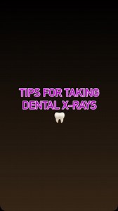 🦷Tips for taking dental x-rays. I would always practice on myself. I will always use a rinn set-up. #dentalassistant #dental #teeth #dentist #dentistry | Dental Assisting with Julie