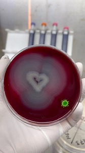 MICROBIOLOGY DIARY 🇳🇵 | Proteus mirabilis on Blood agar plate🦠🧫🔬. Proteus, exhibit some features such as : 🧫Swarming Motility: Proteus species are known for their... | Instagram