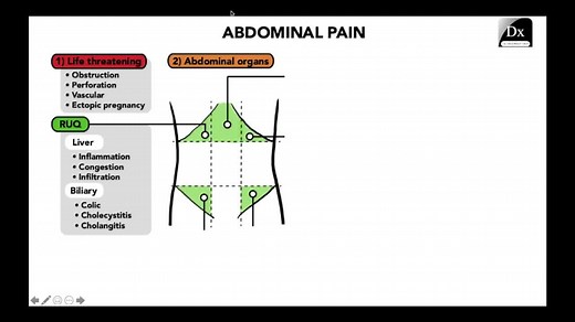 Dx Schema – Abdominal Pain