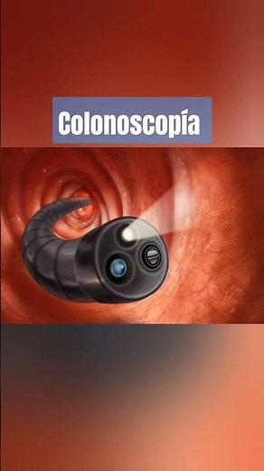 COLONOSCOPY Study to evaluate the colon