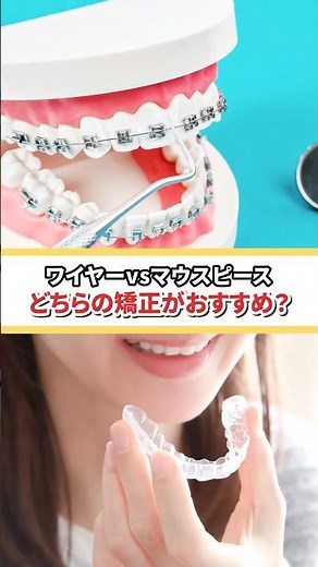 ワイヤーvsマウスピース どちらの矯正がおすすめ？#歯医者 #矯正歯科 #マウスピース矯正