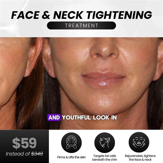  Poway Ladies! Ready to Lift, Tighten & Glow for the Holidays? ...