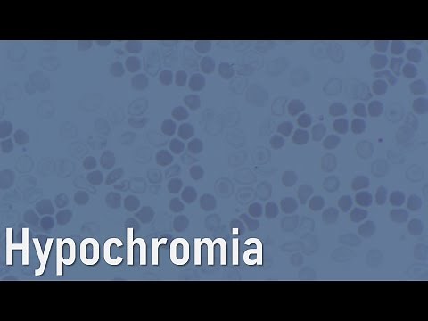 Red cells: Hypochromia
