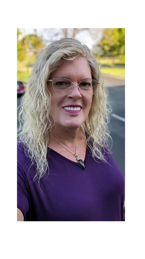 2024 Facial Feminization Surgery Journey from 2 days before to 18 days after