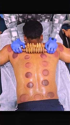 [ASMR] He said He enjoys sound when I remove each cup#asmr#cuppingtherapy#relax#painrehabb#reels