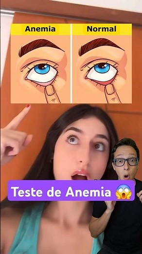 Teste de Anemia 😱#medicina #medico #enfermagem #enfermeira #enfermeiro #dicas como saber se tenho