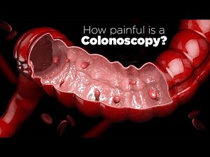 How painful is a colonoscopy? | Dr. Kunal Das, Gastroenterology | Expert Advise