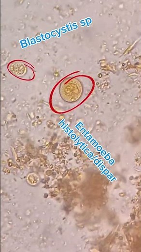 entamoeba histolytica under the microscope 🔬#microbiology #parasite #entamoeba #analysis #medical