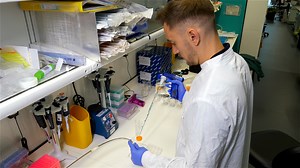 Author Spotlight: Imaging ATG9A, a Multi-Spanning Membrane Protein