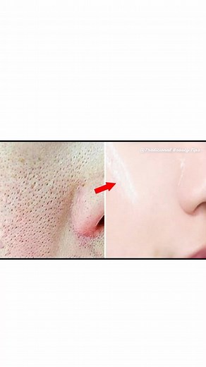 Natural Skincare Recipe for Whiter, Tighter Skin