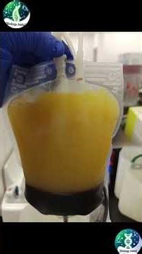 How Blood is Separated in Blood Bank 🩸 | Centrifuge Process Explained#shorts