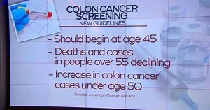 New guidelines for colon cancer screenings